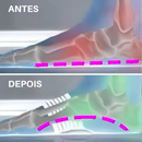 Faixa de Suporte para Arco - Pedivit